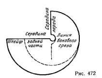 tmp2ee-175